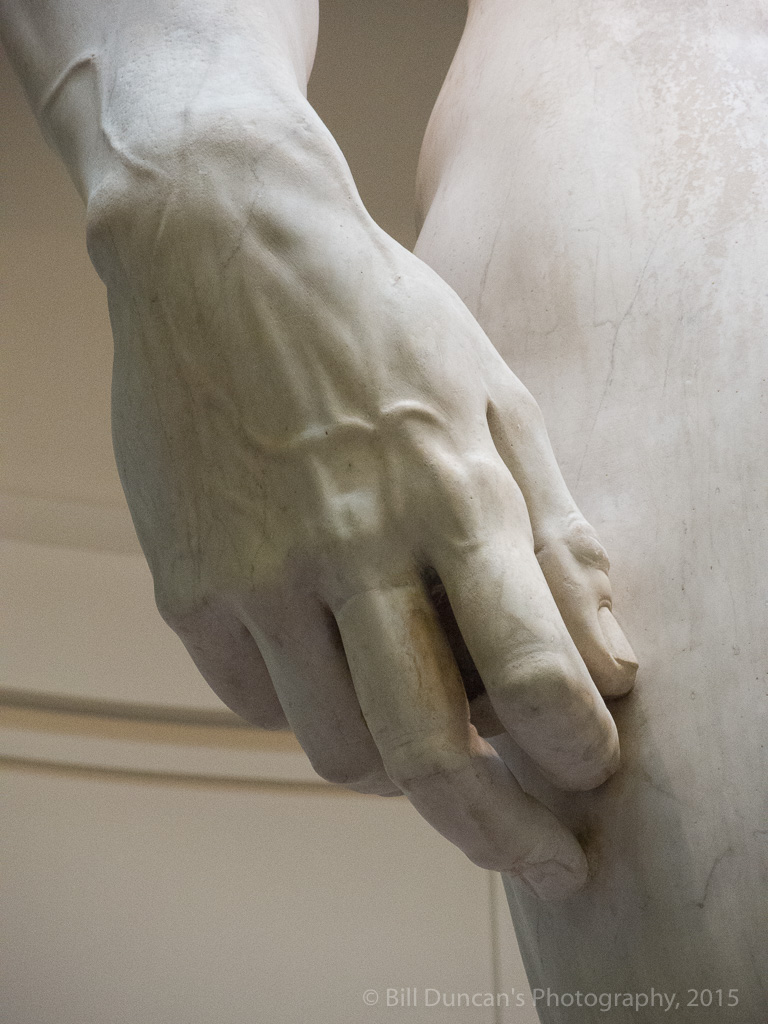 The right hand is disproportionately large.